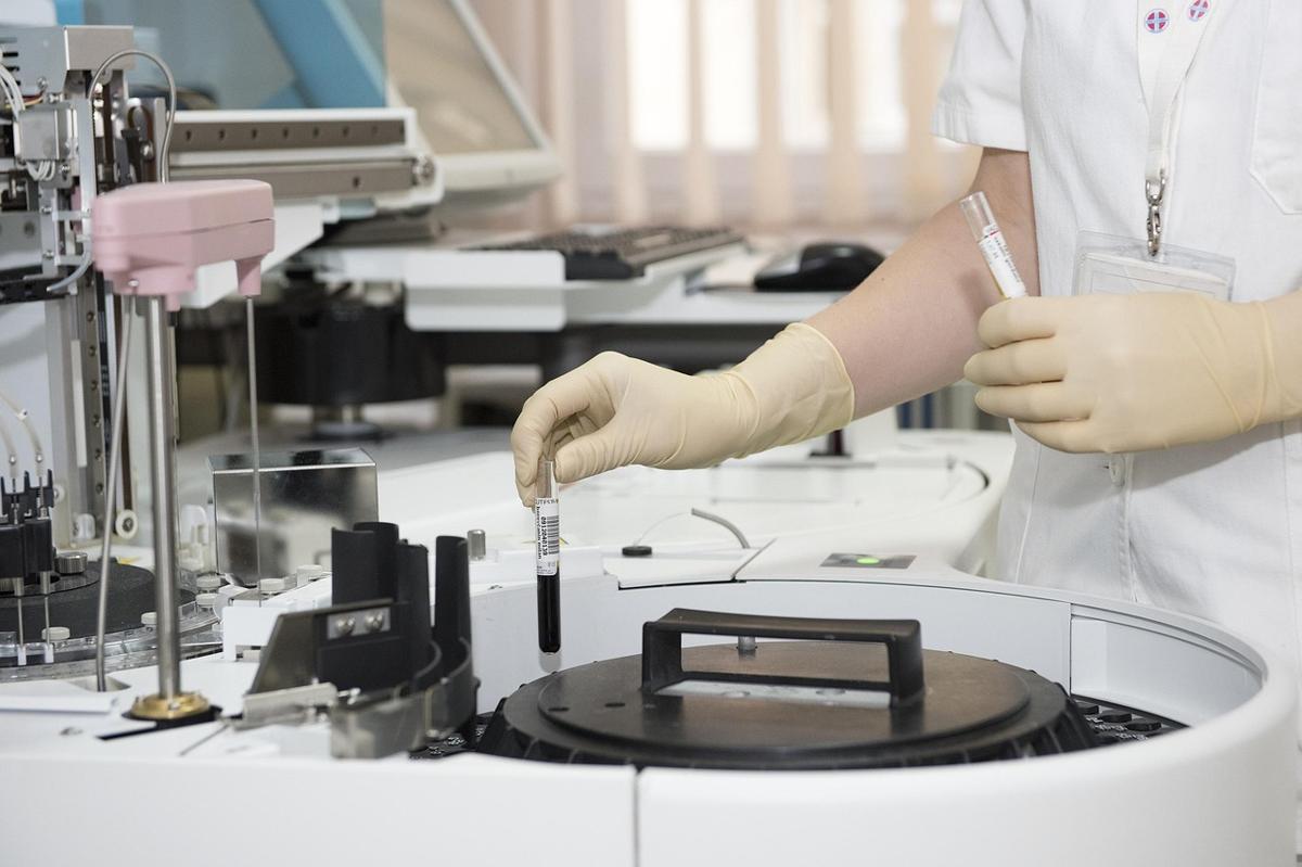 Laboratory blood sample for an HbA1c test