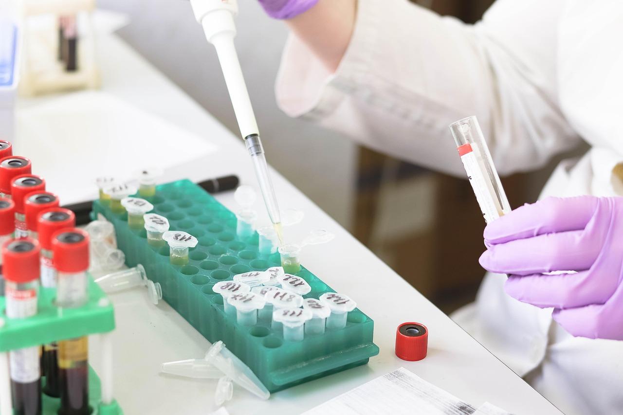 Phlebotomist preparing a blood sample vial for HbA1c testing